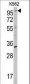 Receptor Tyrosine Kinase Like Orphan Receptor 2 antibody, LS-C99126, Lifespan Biosciences, Western Blot image 