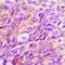 Mitochondrial Ribosomal Protein L1 antibody, LS-C668812, Lifespan Biosciences, Immunohistochemistry paraffin image 