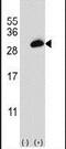 PA28b antibody, PA5-13651, Invitrogen Antibodies, Western Blot image 