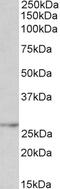 Tribbles homolog 1 antibody, 42-869, ProSci, Western Blot image 