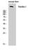 FBN1 antibody, STJ93049, St John