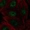 Protein CBFA2T3 antibody, NBP2-56012, Novus Biologicals, Immunocytochemistry image 