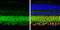 Solute Carrier Family 12 Member 5 antibody, GTX133130, GeneTex, Immunohistochemistry paraffin image 