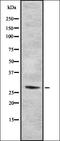 DMRT Like Family B With Proline Rich C-Terminal 1 antibody, orb335257, Biorbyt, Western Blot image 