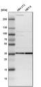 Proteasome 26S Subunit, Non-ATPase 14 antibody, HPA002114, Atlas Antibodies, Western Blot image 