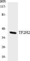 General Transcription Factor IIH Subunit 2 antibody, EKC1805, Boster Biological Technology, Western Blot image 