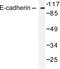 Cadherin 1 antibody, LS-C175997, Lifespan Biosciences, Western Blot image 