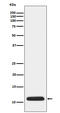 Apolipoprotein C3 antibody, M01416, Boster Biological Technology, Western Blot image 