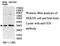 Iodotyrosine Deiodinase antibody, MBS415548, MyBioSource, Western Blot image 