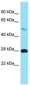 Transmembrane Protein 65 antibody, TA334796, Origene, Western Blot image 