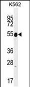 Keratin 25 antibody, PA5-48148, Invitrogen Antibodies, Western Blot image 