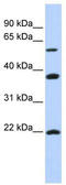 Myosin Regulatory Light Chain Interacting Protein antibody, TA329831, Origene, Western Blot image 