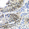 Dachshund Family Transcription Factor 1 antibody, A6895, ABclonal Technology, Immunohistochemistry paraffin image 
