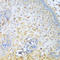 Myosin Heavy Chain 9 antibody, A00880-1, Boster Biological Technology, Immunohistochemistry paraffin image 