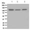 Transient Receptor Potential Cation Channel Subfamily M Member 8 antibody, ab109308, Abcam, Western Blot image 