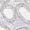 TNFAIP3 Interacting Protein 1 antibody, NBP2-32658, Novus Biologicals, Immunohistochemistry frozen image 