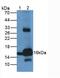 Hemoglobin Subunit Alpha 2 antibody, LS-C294440, Lifespan Biosciences, Western Blot image 