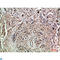 TLE Family Member 1, Transcriptional Corepressor antibody, LS-C813567, Lifespan Biosciences, Immunohistochemistry paraffin image 