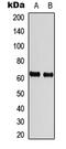 Checkpoint Kinase 2 antibody, LS-C358945, Lifespan Biosciences, Western Blot image 