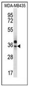 Olfactory Receptor Family 51 Subfamily Q Member 1 (Gene/Pseudogene) antibody, AP53073PU-N, Origene, Western Blot image 