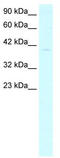 General Transcription Factor IIB antibody, TA330172, Origene, Western Blot image 