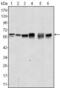 AKT Serine/Threonine Kinase 2 antibody, MA5-15593, Invitrogen Antibodies, Western Blot image 