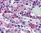 Arginine Vasopressin Receptor 1B antibody, NB100-96917, Novus Biologicals, Immunohistochemistry paraffin image 