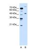 Tripartite Motif Containing 42 antibody, NBP1-55074, Novus Biologicals, Western Blot image 