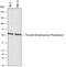 Pyruvate Dehyrogenase Phosphatase Catalytic Subunit 1 antibody, AF7260, R&D Systems, Western Blot image 