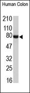 Signal Transducer And Activator Of Transcription 1 antibody, 251896, Abbiotec, Western Blot image 