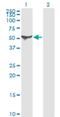 Aldehyde Dehydrogenase 1 Family Member A1 antibody, H00000216-M05, Novus Biologicals, Western Blot image 