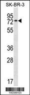 Methyl-CpG Binding Domain 4, DNA Glycosylase antibody, 60-515, ProSci, Western Blot image 