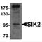 Salt Inducible Kinase 2 antibody, MBS150970, MyBioSource, Western Blot image 