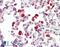 Core-Binding Factor Subunit Beta antibody, 43-373, ProSci, Western Blot image 