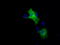 B-Raf Proto-Oncogene, Serine/Threonine Kinase antibody, LS-C114924, Lifespan Biosciences, Immunofluorescence image 