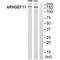 Rho Guanine Nucleotide Exchange Factor 11 antibody, A04614, Boster Biological Technology, Western Blot image 