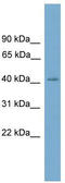 SAM and SH3 domain-containing protein 3 antibody, TA344828, Origene, Western Blot image 
