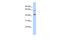 NAD Kinase 2, Mitochondrial antibody, GTX45619, GeneTex, Western Blot image 