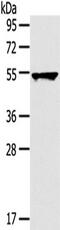 Tripartite Motif Containing 10 antibody, TA350506, Origene, Western Blot image 