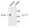 Arachidonate 5-Lipoxygenase antibody, NB300-277, Novus Biologicals, Western Blot image 