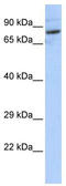 Serine Palmitoyltransferase Long Chain Base Subunit 2 antibody, TA346733, Origene, Western Blot image 