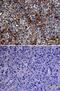 Glypican 3 antibody, AF2119, R&D Systems, Immunohistochemistry frozen image 