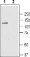 SLC4A4 antibody, TA328912, Origene, Western Blot image 