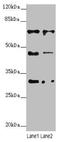 Zinc Finger Protein 785 antibody, LS-C676756, Lifespan Biosciences, Western Blot image 