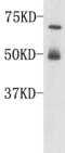 Complement C3 antibody, TA323744, Origene, Western Blot image 