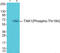 Mitogen-Activated Protein Kinase Kinase Kinase 7 antibody, abx012502, Abbexa, Western Blot image 