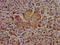 Hepsin antibody, CSB-PA010704LA01HU, Cusabio, Immunohistochemistry paraffin image 