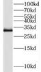 Neuralized E3 Ubiquitin Protein Ligase 2 antibody, FNab05671, FineTest, Western Blot image 