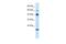 Zinc Finger Protein 24 antibody, PA5-40731, Invitrogen Antibodies, Western Blot image 