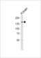 Transient Receptor Potential Cation Channel Subfamily M Member 8 antibody, LS-C100967, Lifespan Biosciences, Western Blot image 